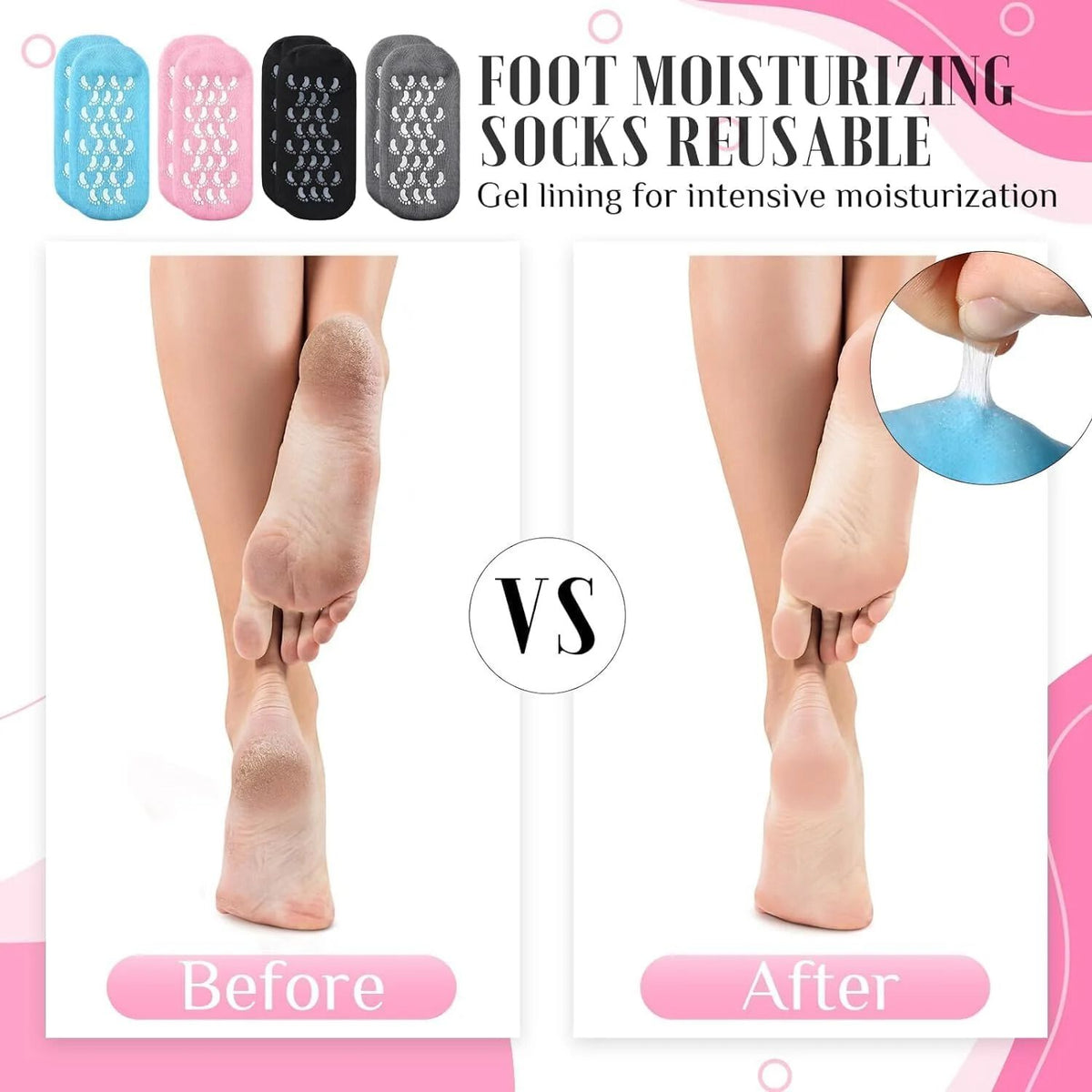 Gel Spa Gel Socks for Cracked Skin Gel Spa Gel Socks for Cracked Skin